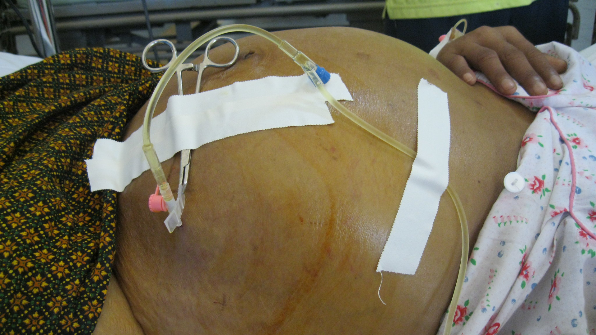 Physiotherapy & Rehabilitation